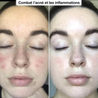 SculptVisage Pro™ - Obtenez une peau parfaitement rajeunie et éclatante en 2 semaines ✨