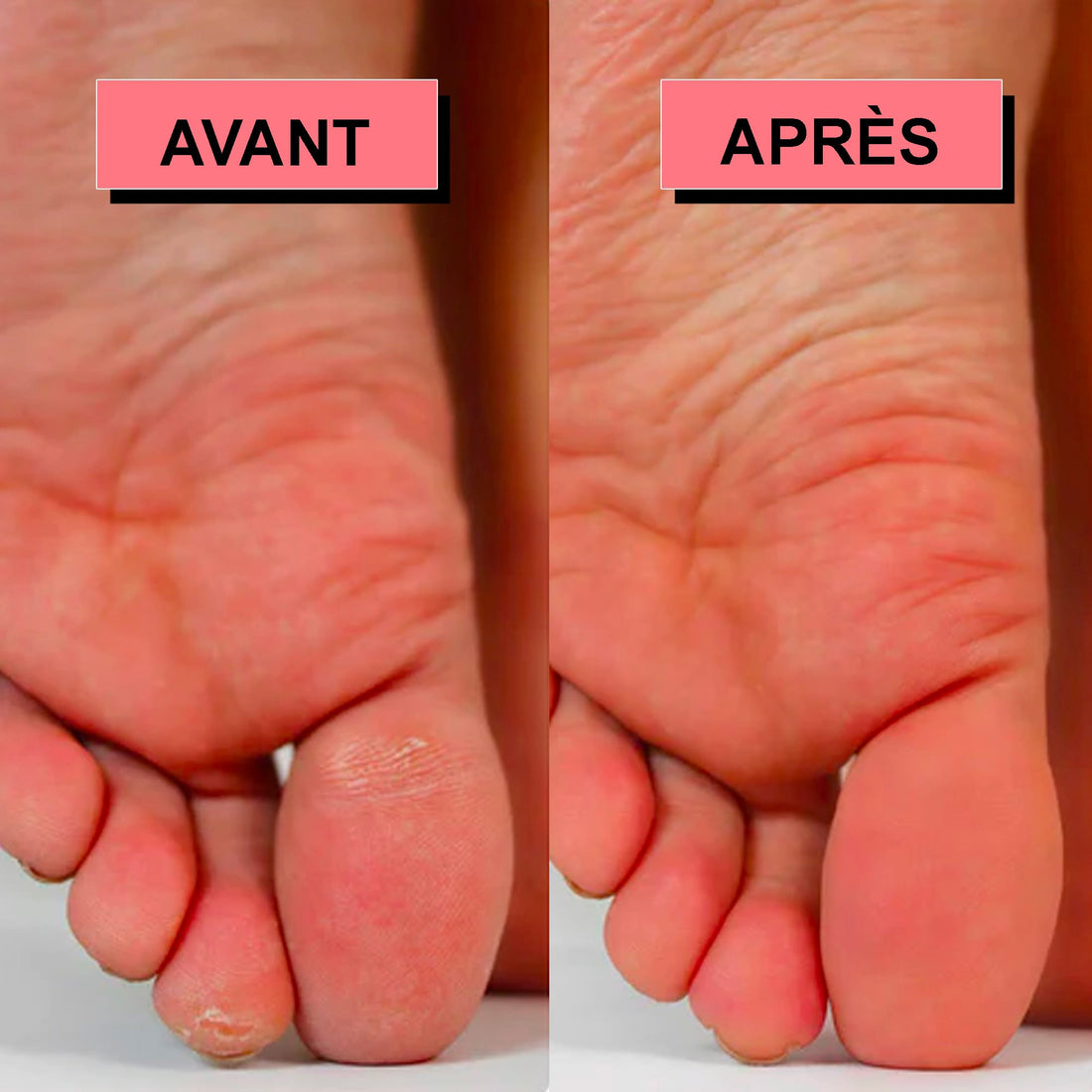 Rape a pied electrique