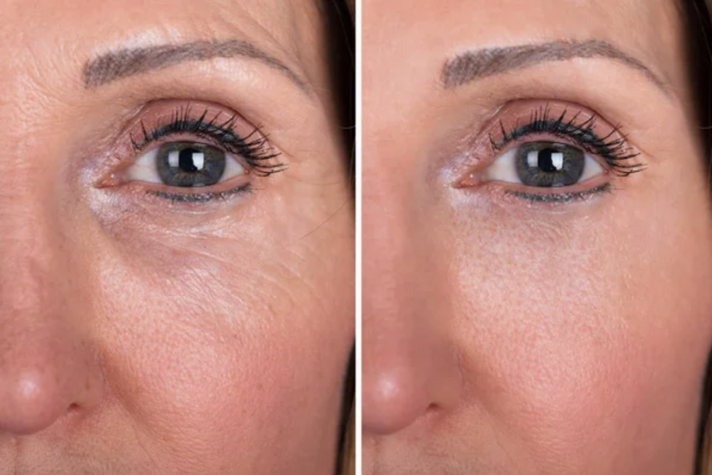 SculptVisage Pro™ - Obtenez une peau parfaitement rajeunie et éclatante en 2 semaines ✨