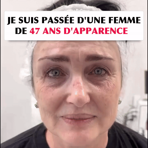 SculptVisage Pro™ - Obtenez une peau parfaitement rajeunie et éclatante en 2 semaines ✨